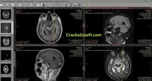 free dicom viewer for mac free dicom viewer for mac
